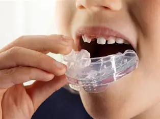 Myobrace Treatment